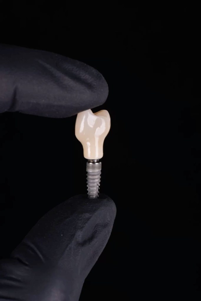 οδοντικο εμφυτευμα , dental implant